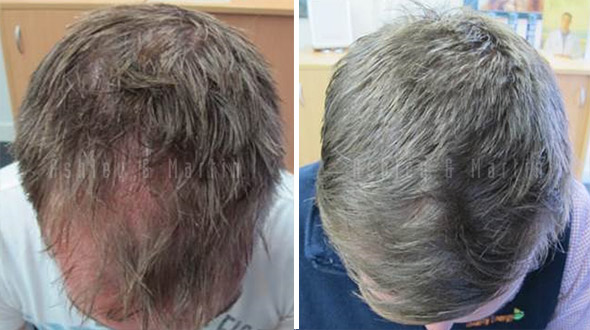 Hair Wars: Hair and Australian Architects or why I never made the grade as a star&nbsp;architect.